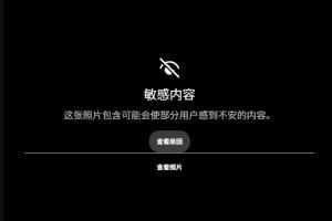 露骨！慎入！范德彪小拇指的骨頭直接刺出來(lái)了！