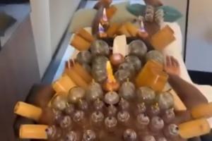 神秘力量！30歲奧納納恢復(fù)治療，從肩部到小腿密密麻麻拔滿罐！